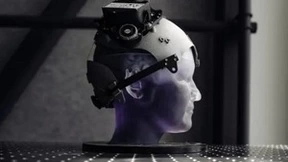 脑机接口技术迎来突破性进展 临床试验开启新纪元